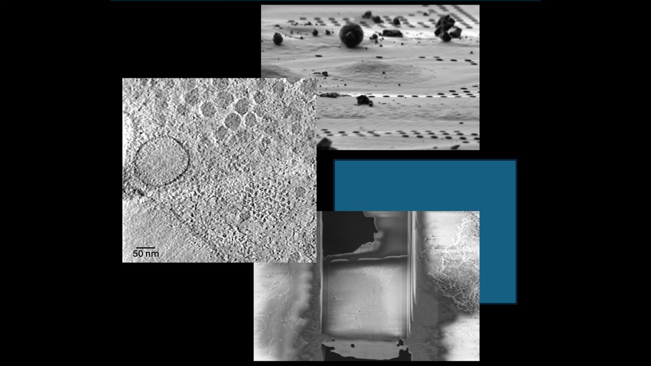 The cryo-electron tomography workflow featuring scanning electron images of a cellular lamella and one slice from a transmission electron tomogram from a lamella