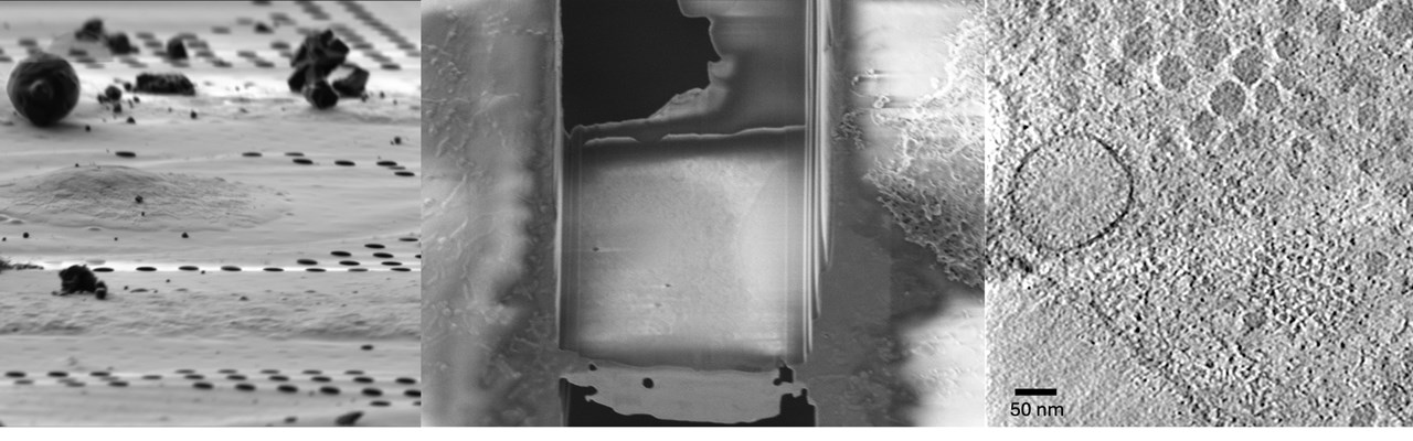 The cryo-electron tomography workflow featuring scanning electron images of a cellular lamella and one slice from a transmission electron tomogram from a lamella