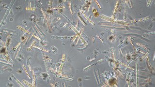 Springbloom of phytoplankton throug a microskope.