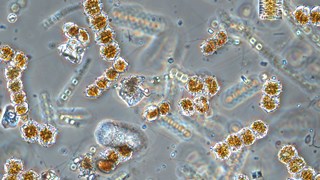 mikroskopbild på vårblomning av växtplankton.