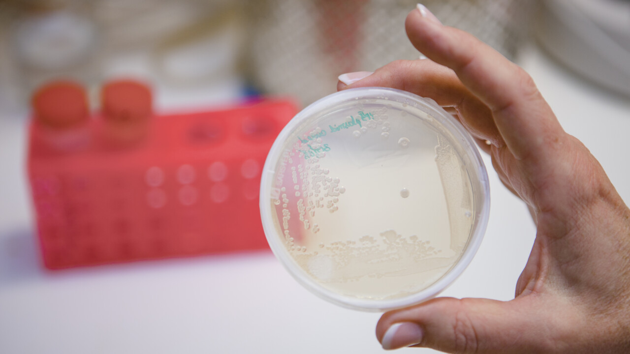 New Class Of Antibiotics Effective Against Multidrug Resistant Bacteria   Bakterieodling 10687crop017956163159resize1280720autoorientquality90density150stripextensionjpgid16 