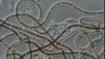 alger i mikroskop
