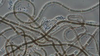 alger i ett mikroskop