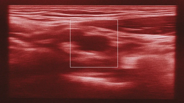 Accessible diagnostics for proactive heart care and failure prevention